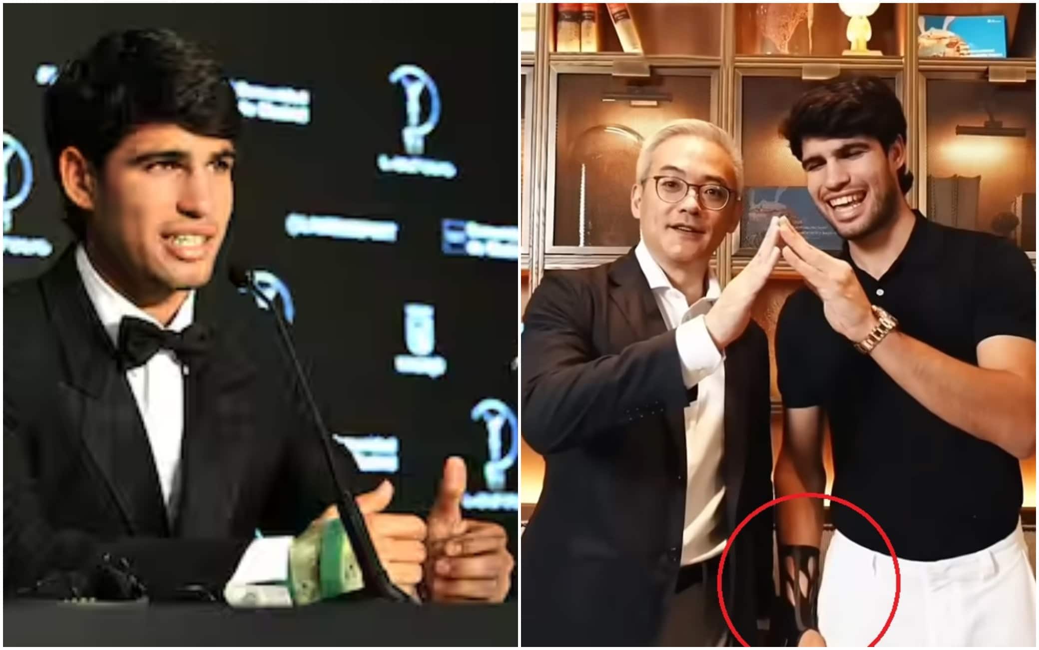 La foto di Alcaraz col nuovo tutore