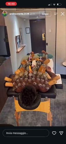Onana si dà alla coppettazione: il VIDEO diventa virale