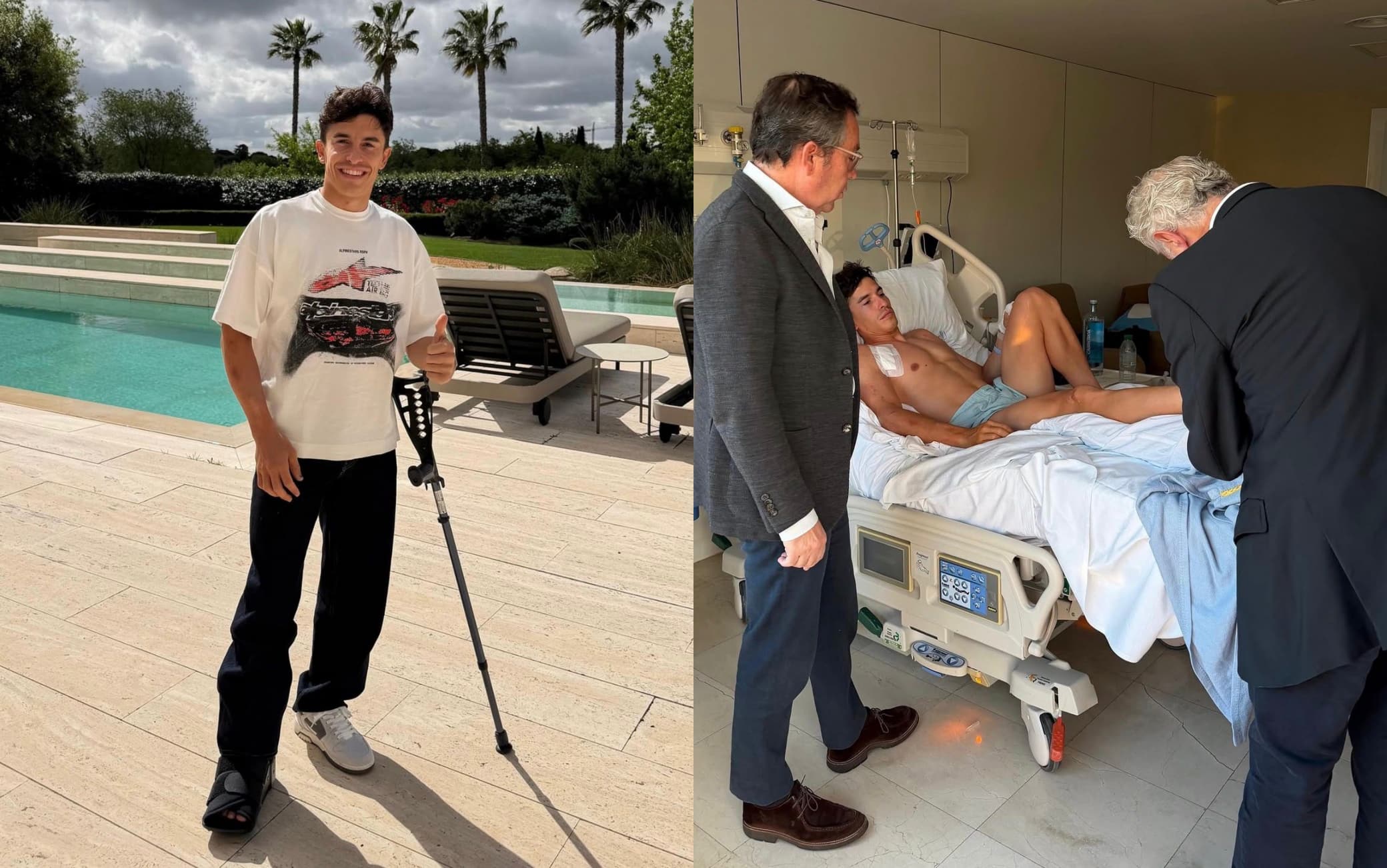 Marc Marquez dopo la doppia operazione: le foto e il messaggio