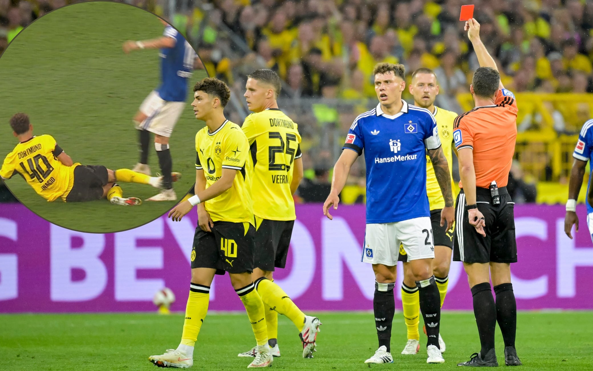 Inacio espulso in Borussia Dortmund-Amburgo: il VIDEO dell'intervento