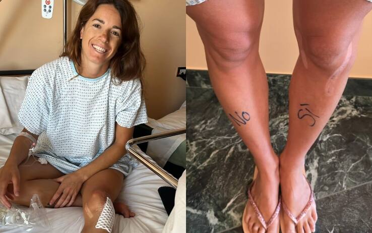 Sci, Marta Bassino operata per rimozione placca al ginocchio. Le news