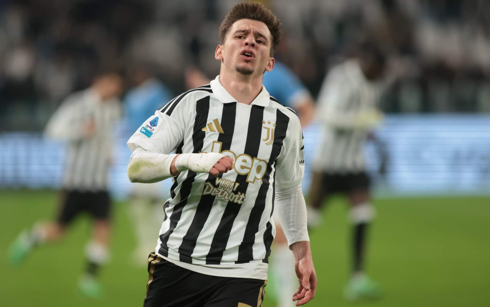 Juventus, Conceiçao ko: lussazione alla spalla, stop fino a novembre