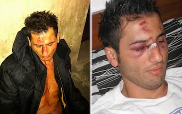 racaj_aggressione_combinata_ansa