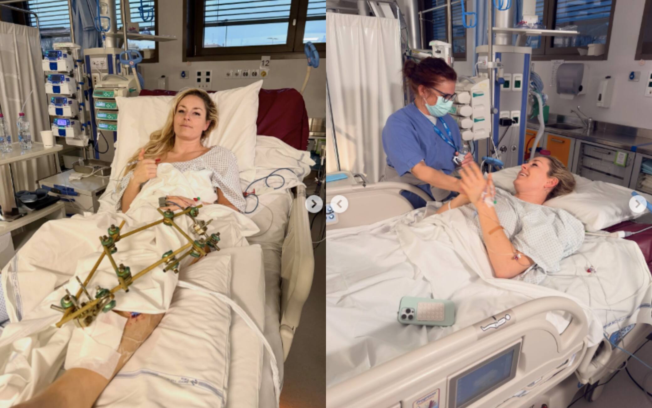 Lindsey Vonn, terza operazione post caduta alle Olimpiadi: le news di oggi