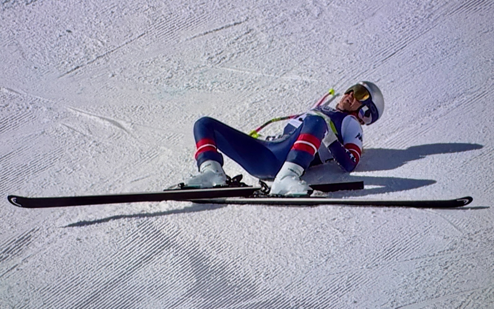 Lindsey Vonn, caduta e condizioni dopo infortunio alle Olimpiadi. FOTO ...