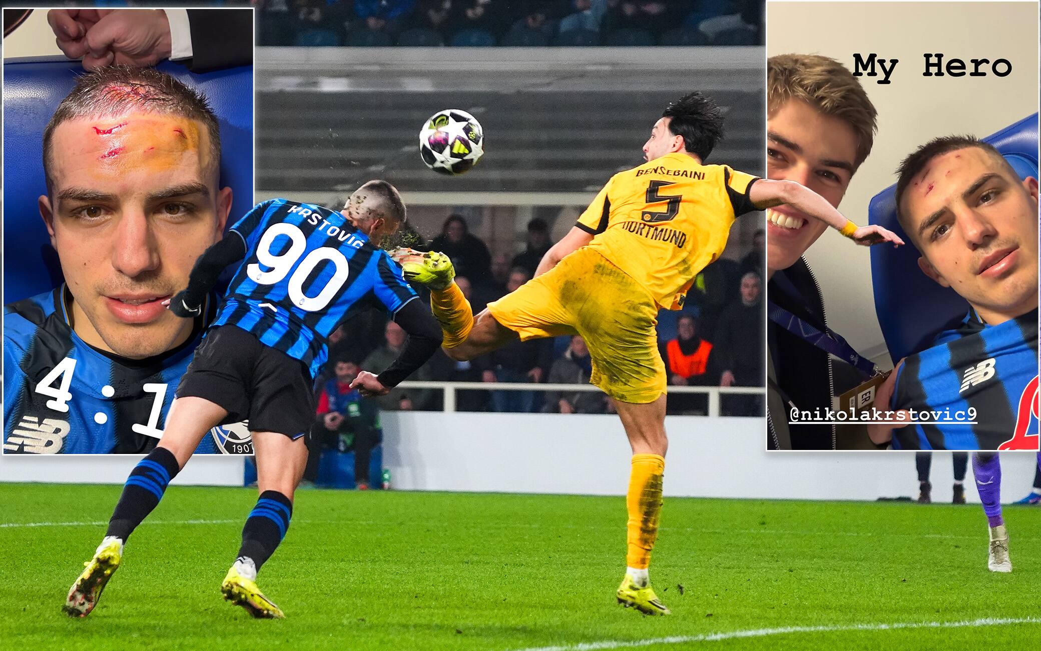 Atalanta, Krstovic: foto dopo il calcio sul volto. De Ketelaere e Samardzic: "Eroe"