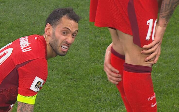 Calhanoglu sostituito in Turchia-Romania: crampo o infortunio al polpaccio?
