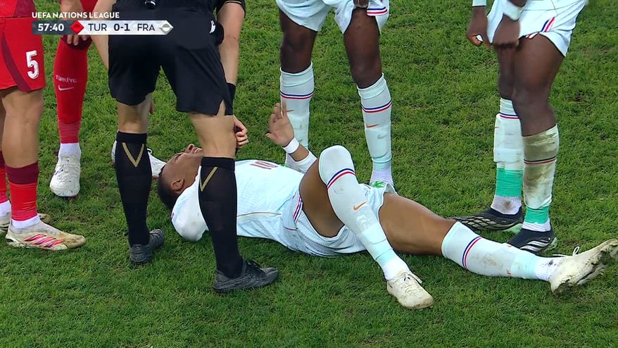 Mbappé, gol e infortunio al ginocchio in Turchia-Francia