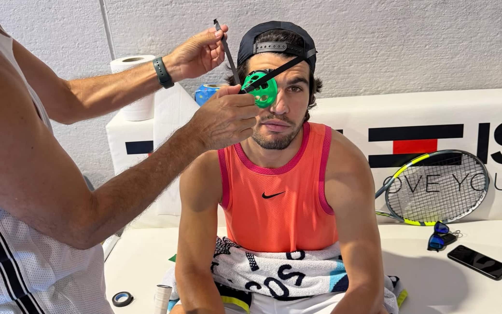 Alcaraz, allenamento con un cono sull'occhio: ecco perché
