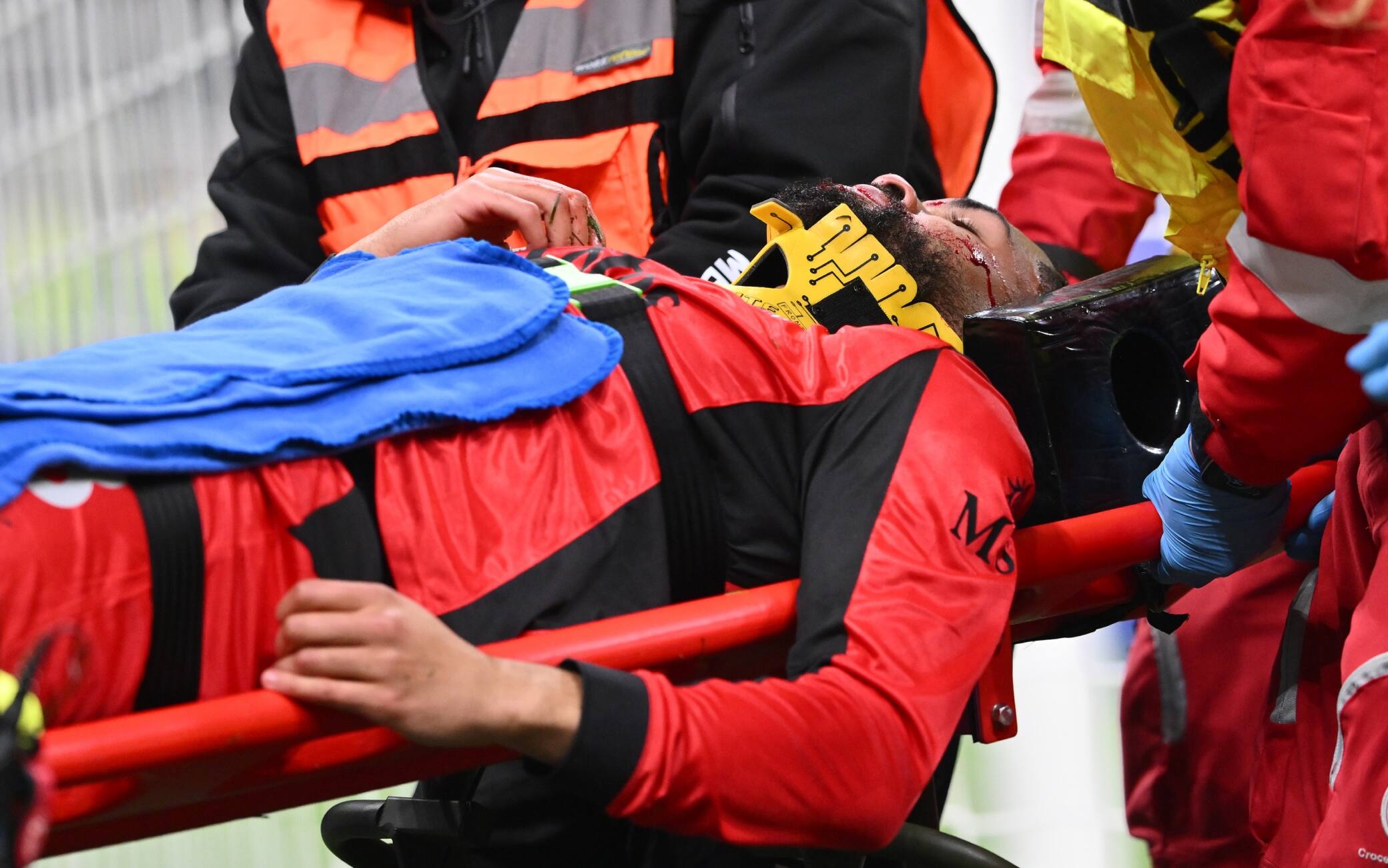 Infortunio Loftus-Cheek, oggi l'operazione per il centrocampista del Milan. News